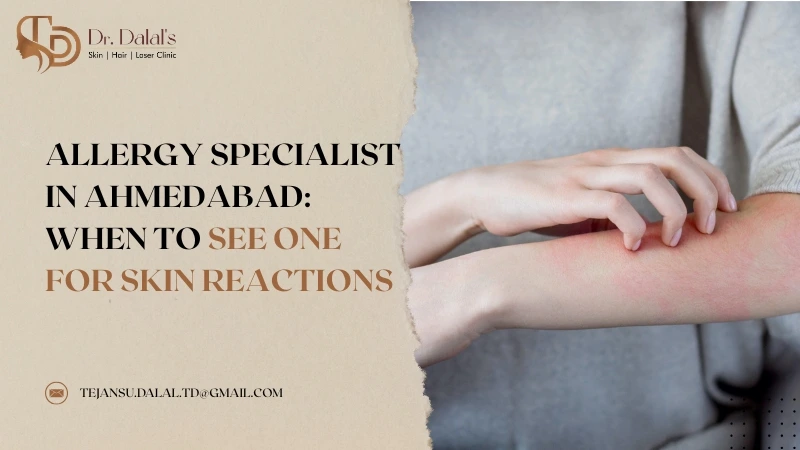 Allergy Specialist in Ahmedabad: When to See One for Skin Reactions