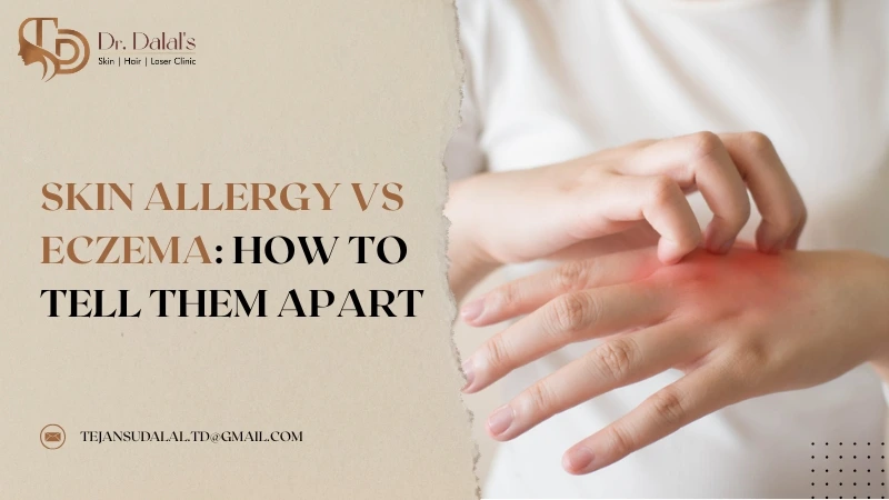 Skin Allergy vs Eczema: How to Tell Them Apart