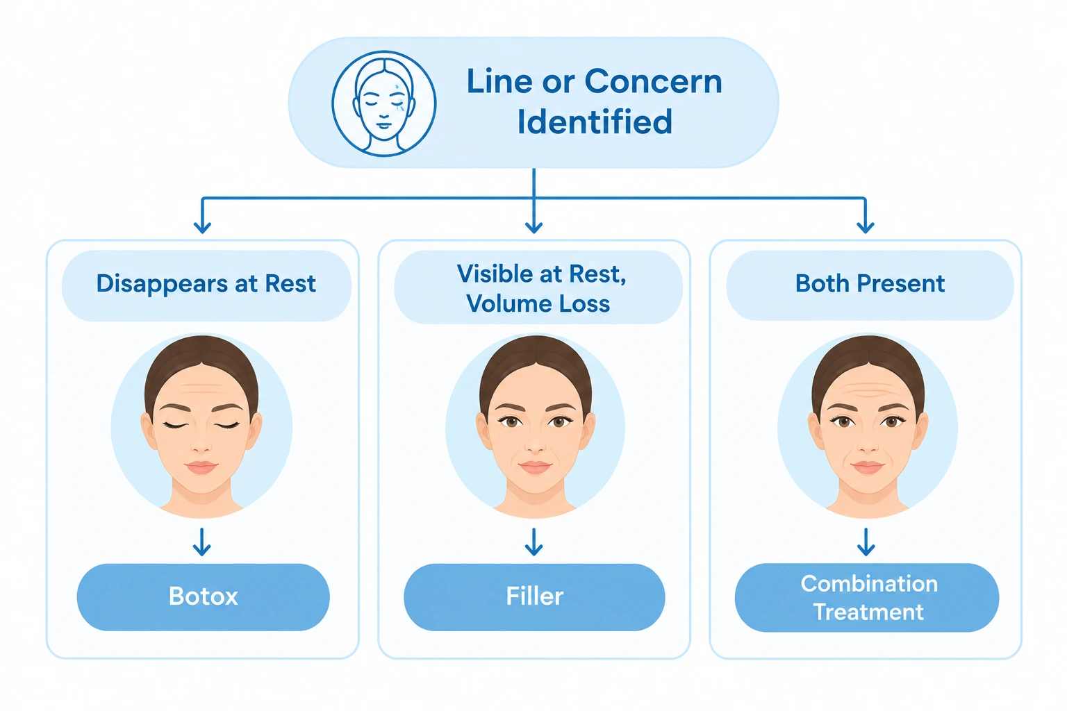 Flowchart showing how the choice between Botox, filler, or combination treatment depends on the type of facial line