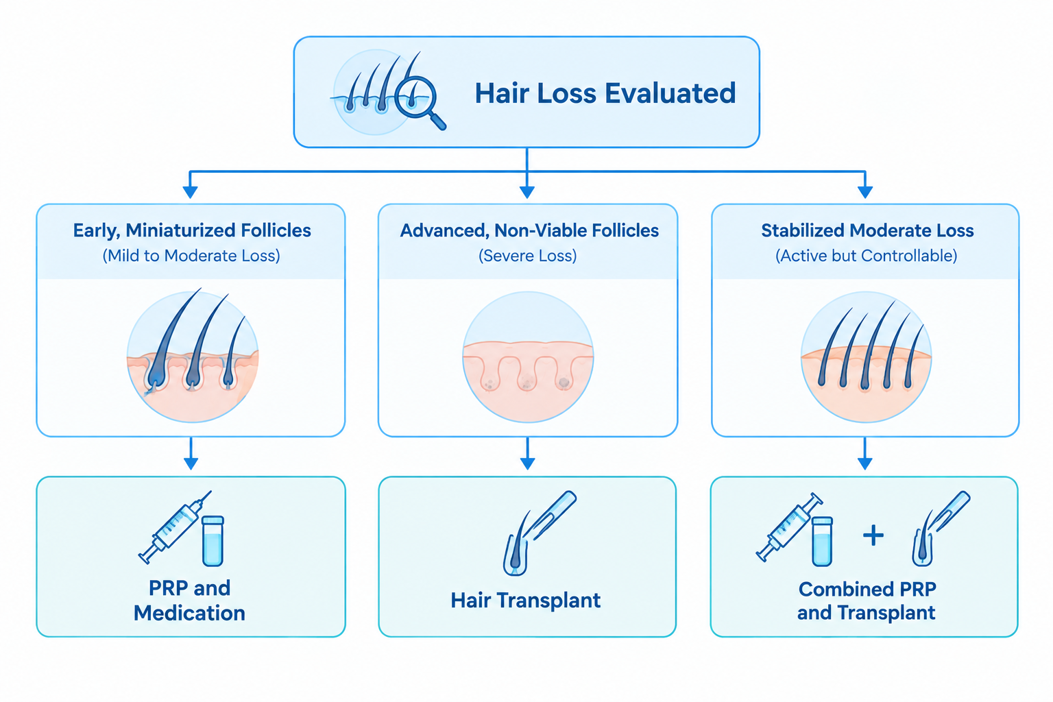 Flowchart showing how the choice between PRP, hair transplant, or a combined approach depends on hair loss stage