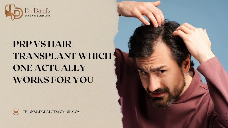 Illustration comparing PRP therapy and hair transplant surgery for hair loss