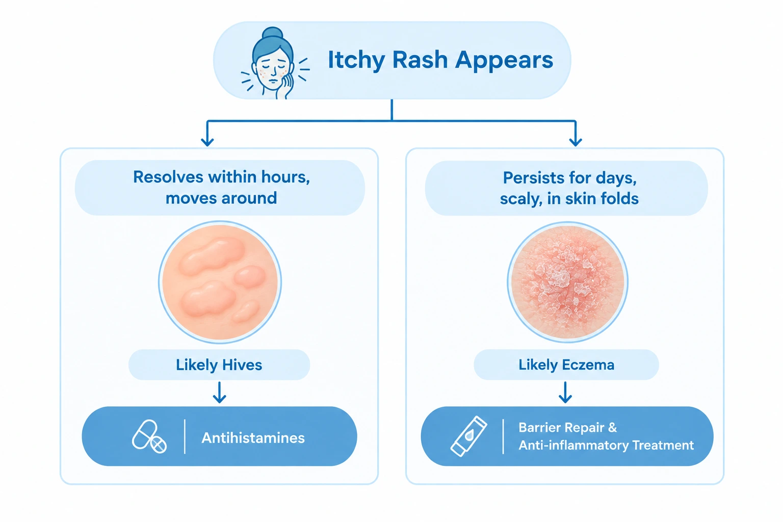 Flowchart showing how rash behavior helps distinguish hives from eczema and guides treatment