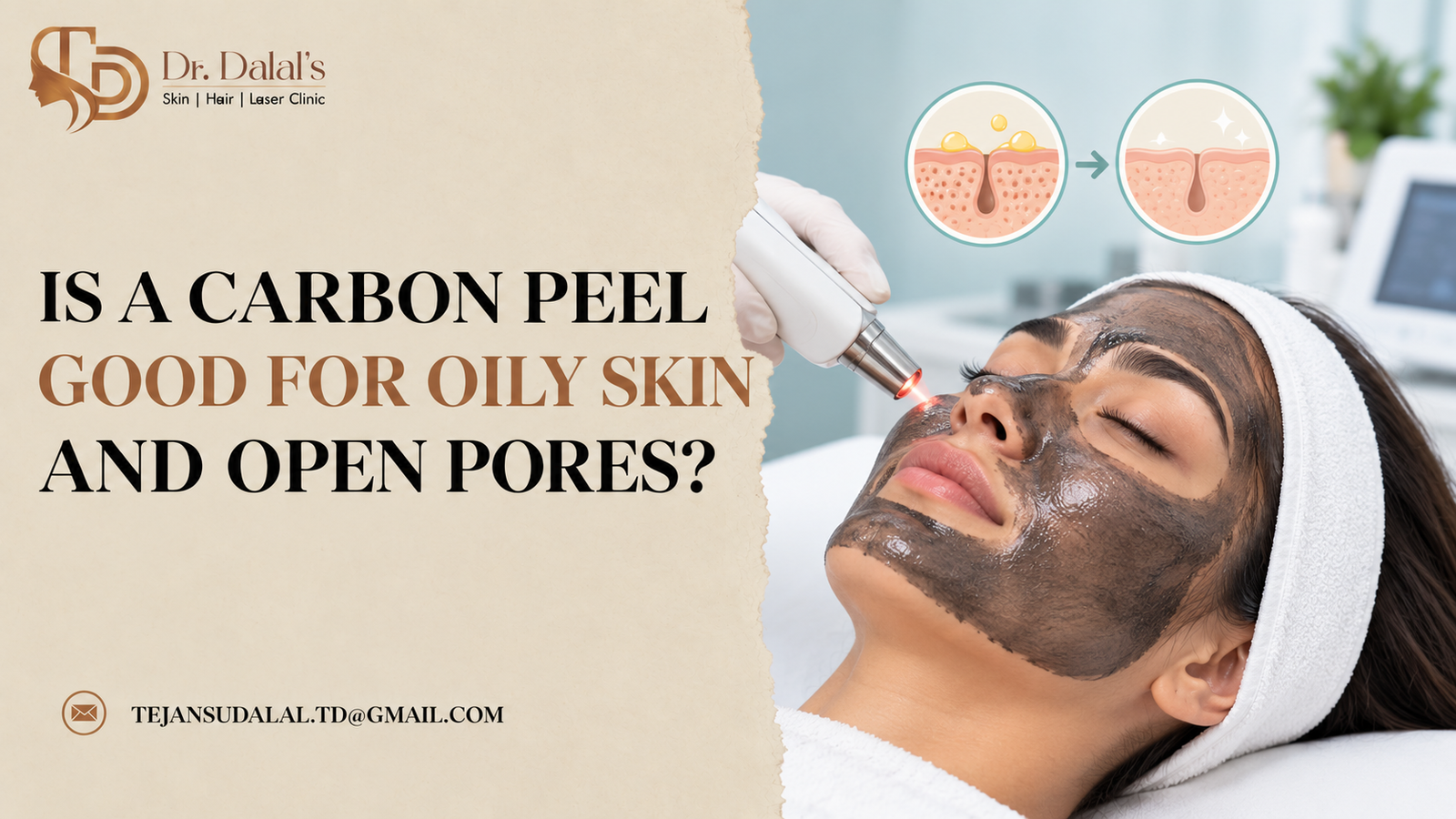 Close view of clear, smooth facial skin after a carbon peel for oily skin and open pores