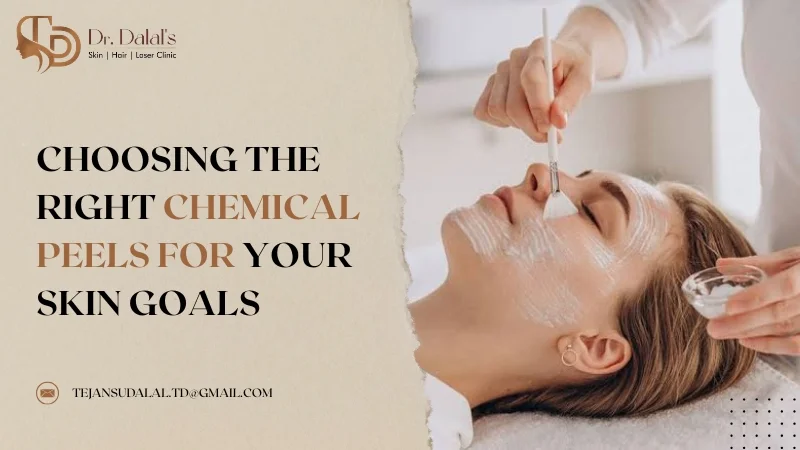 Illustration showing the three depth levels that chemical peels can reach in the skin