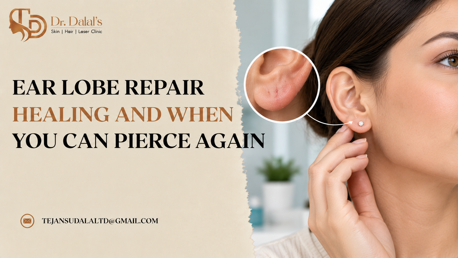 Healed earlobe after ear lobe repair with a small light stud earring