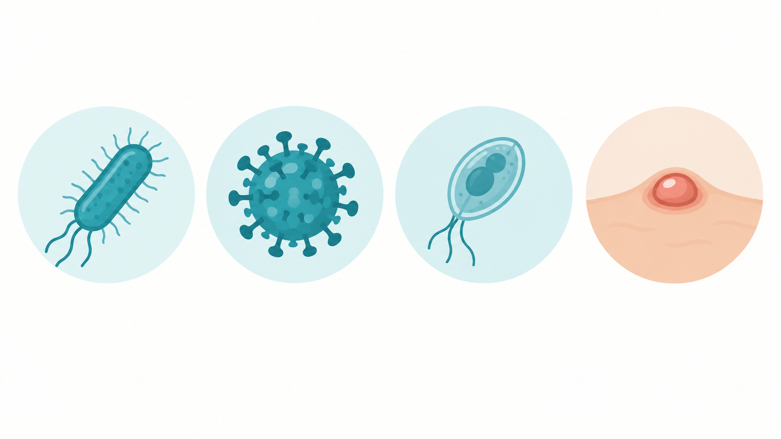 Illustration of the different types of germs that cause sexually transmitted infections