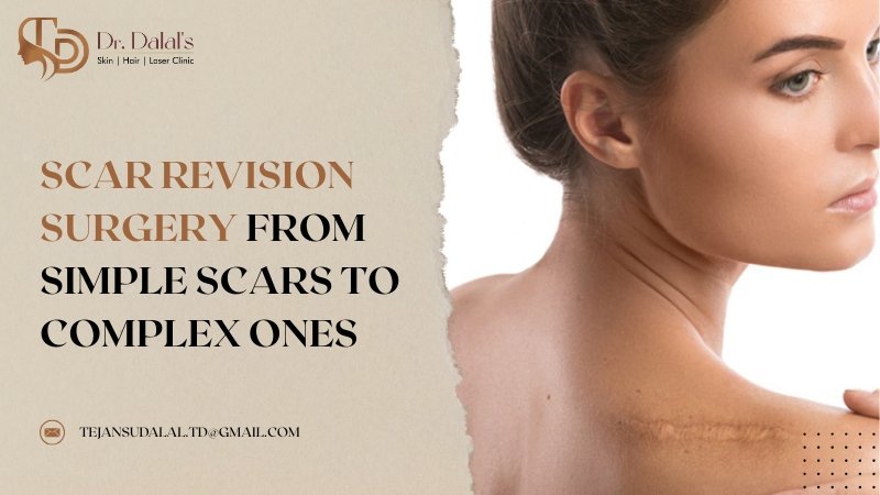 Scar Revision Surgery From Simple Scars to Complex Ones