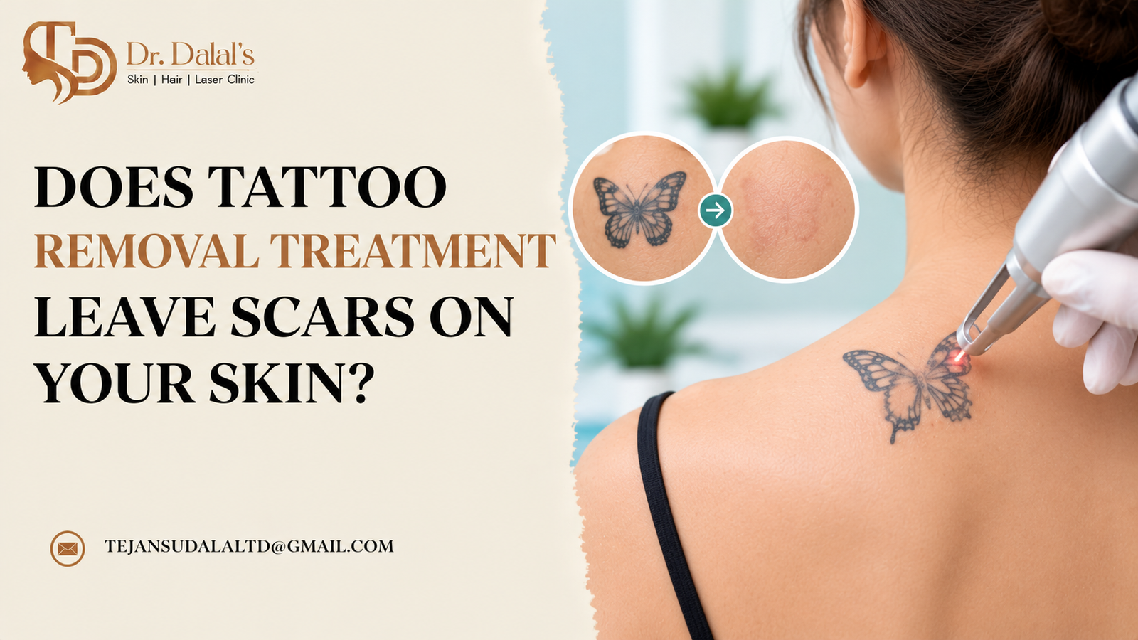 Dermatologist performing tattoo removal treatment on a patient’s forearm