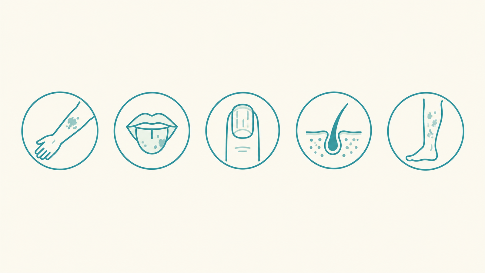 Icon row representing the body areas where lichen planus can appear