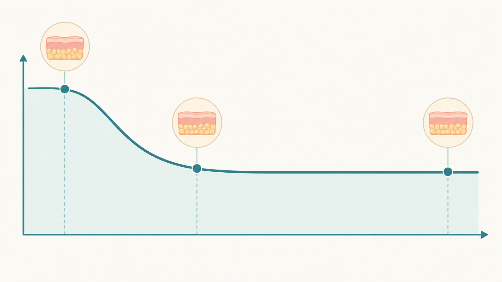 Illustration showing how fat grafting volume reduces early on and then settles into a stable result over time