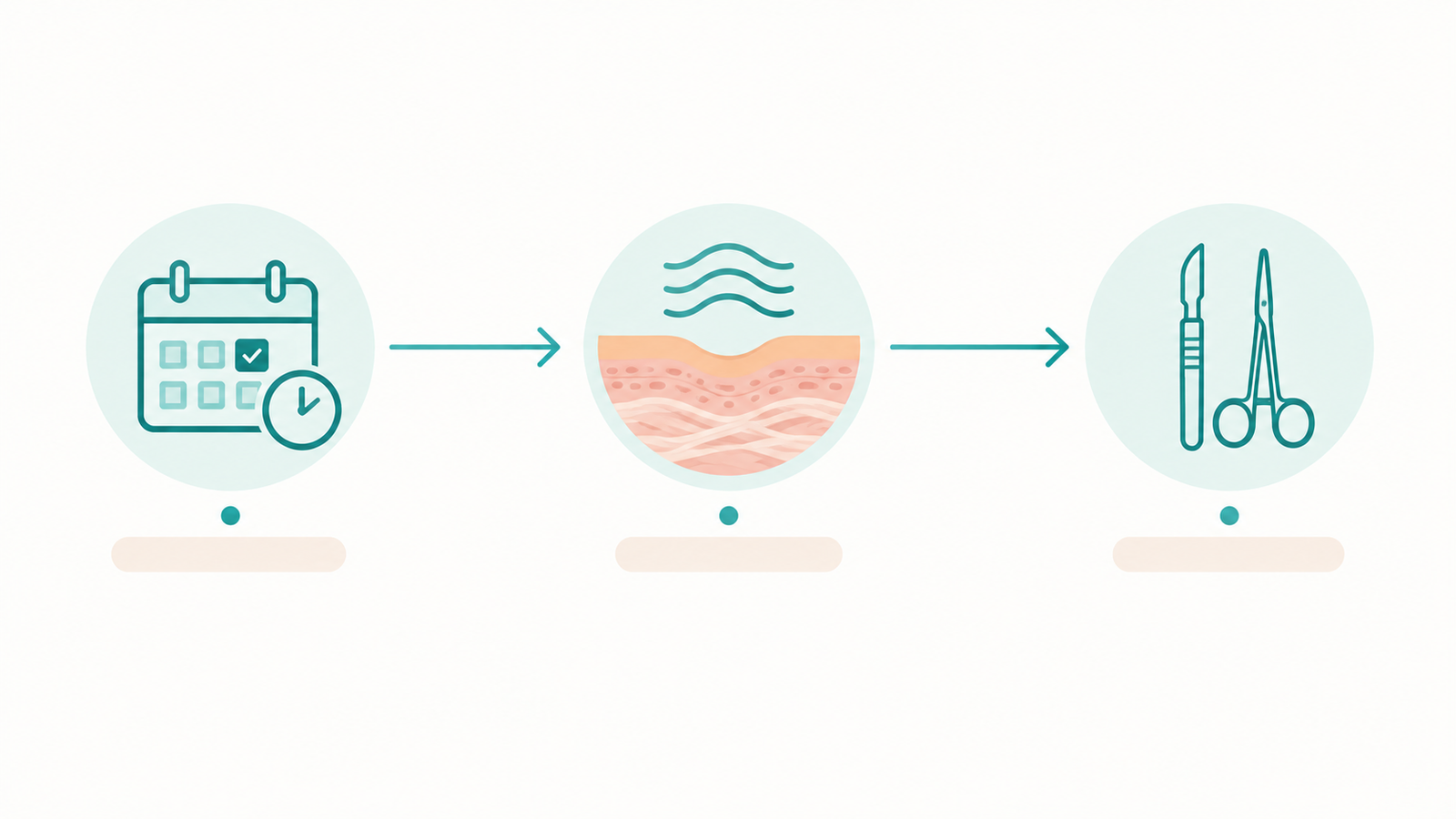 Timeline illustration showing the maturation period before elective scar revision surgery