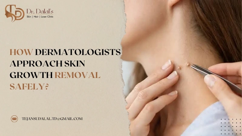 Illustration representing dermatological evaluation and removal of a skin growth