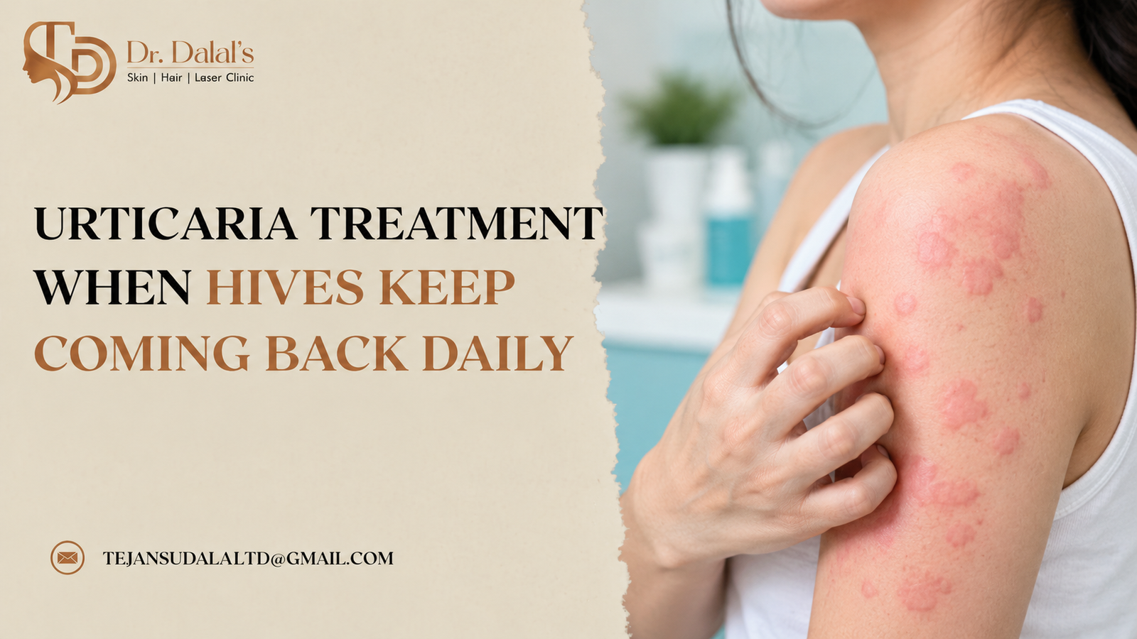 Dermatologist examining raised itchy hives on a patient’s forearm during urticaria treatment
